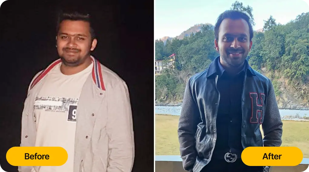 rb-before-after-vinayak
